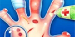 Hand Doctor – Surgery Game For Kids